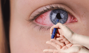 Diabetes and eye diseases