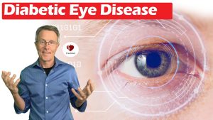 Diabetic Eye Diseases