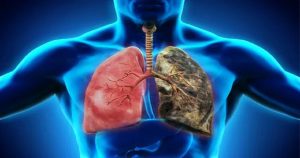 Impact of air quality on respiratory health