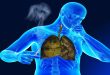 Impact of air quality on respiratory health