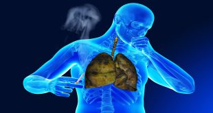 Impact of air quality on respiratory health