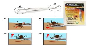 Tick removal 