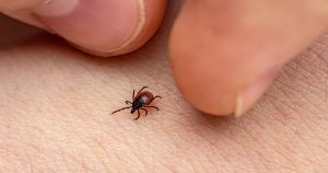 tick removal