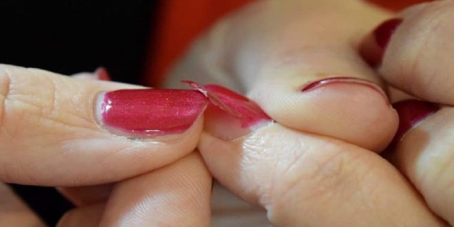 gel nails peeling off