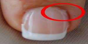 gel nails peeling off