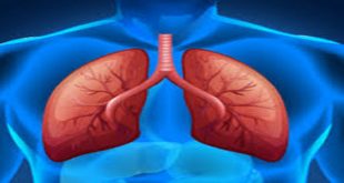 Multifocal Pneumonia