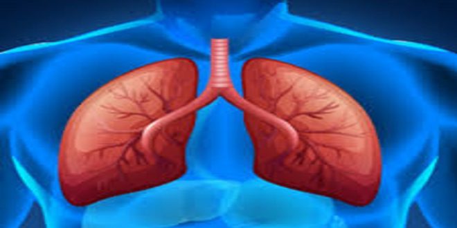 Multifocal Pneumonia